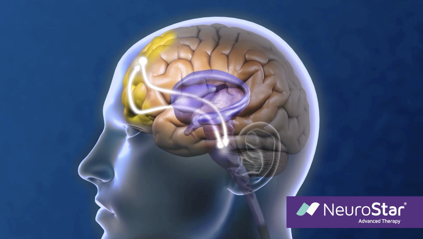 Stimulating-the-deep-brain-with-TMS