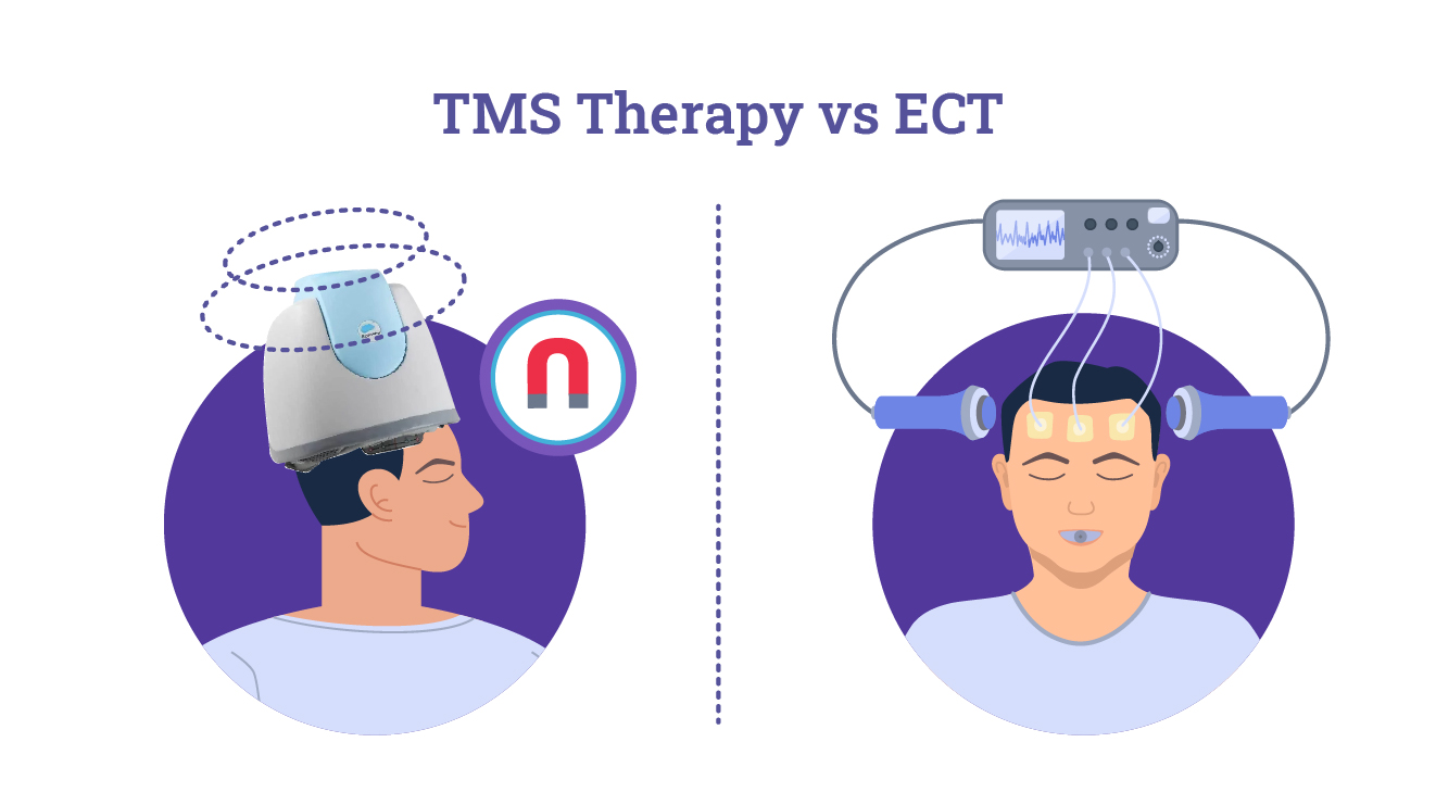 TMS VS ECT