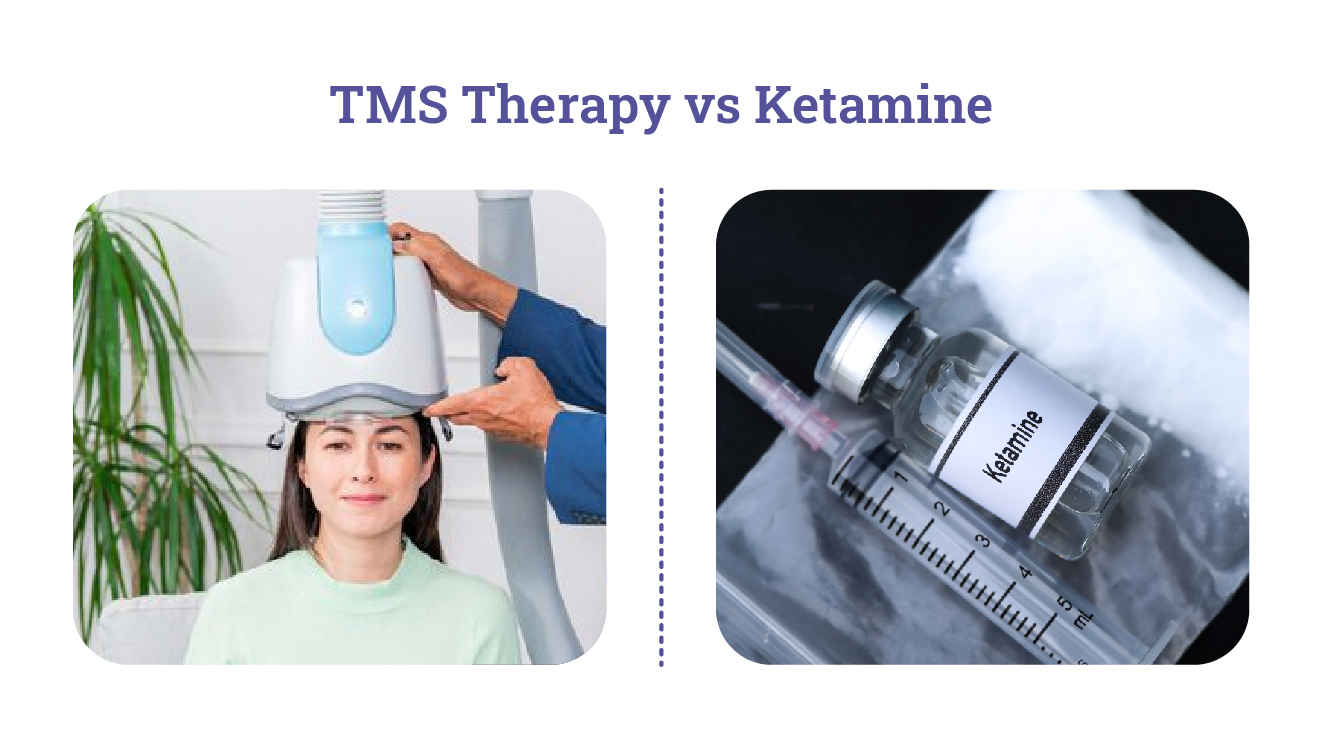 TMS Therapy vs Ketamine